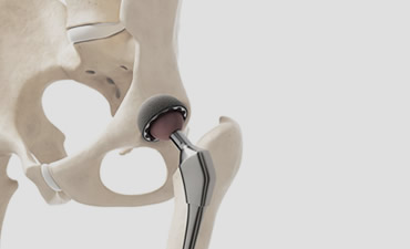 Ortopedia para rodilla guadalajara