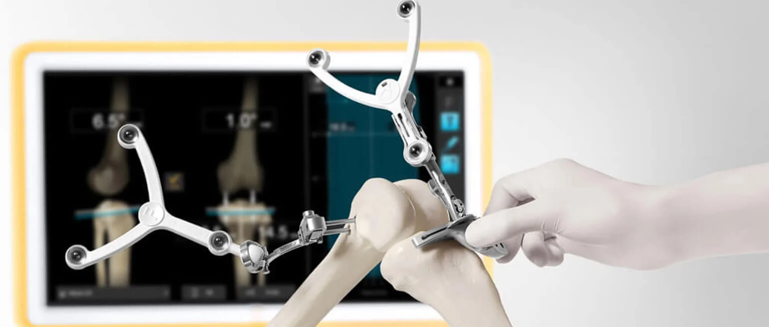 prótesis ortopédicas de rodilla en guadalajara